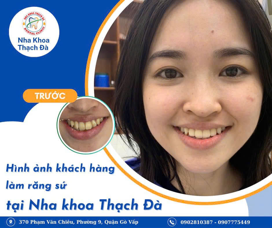 CHỈ THAY ĐỔI NHẸ LÀM TĂNG NÉT ĐẸP TỰ NHIÊN 