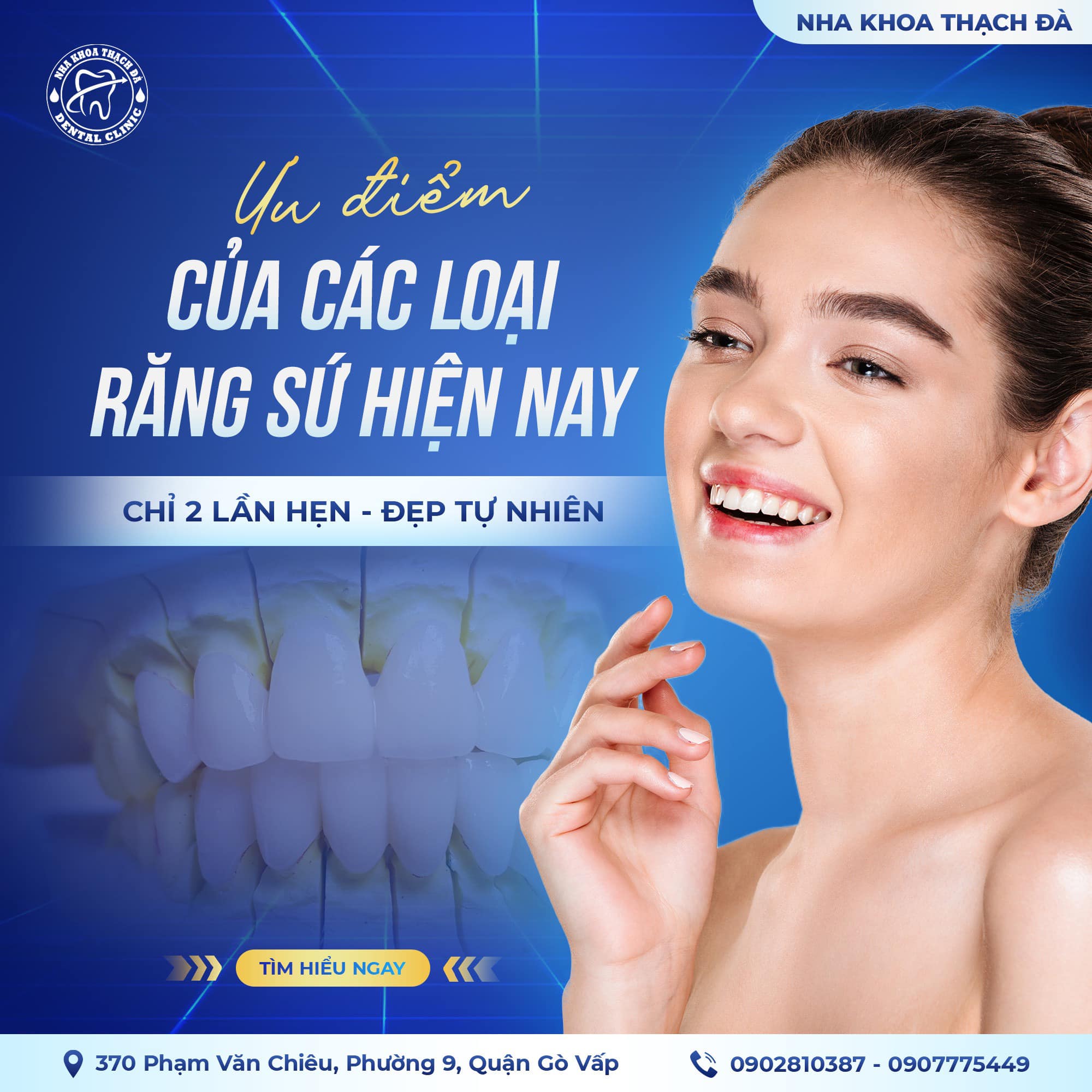 Ưu điểm của những loại răng sứ hiện nay