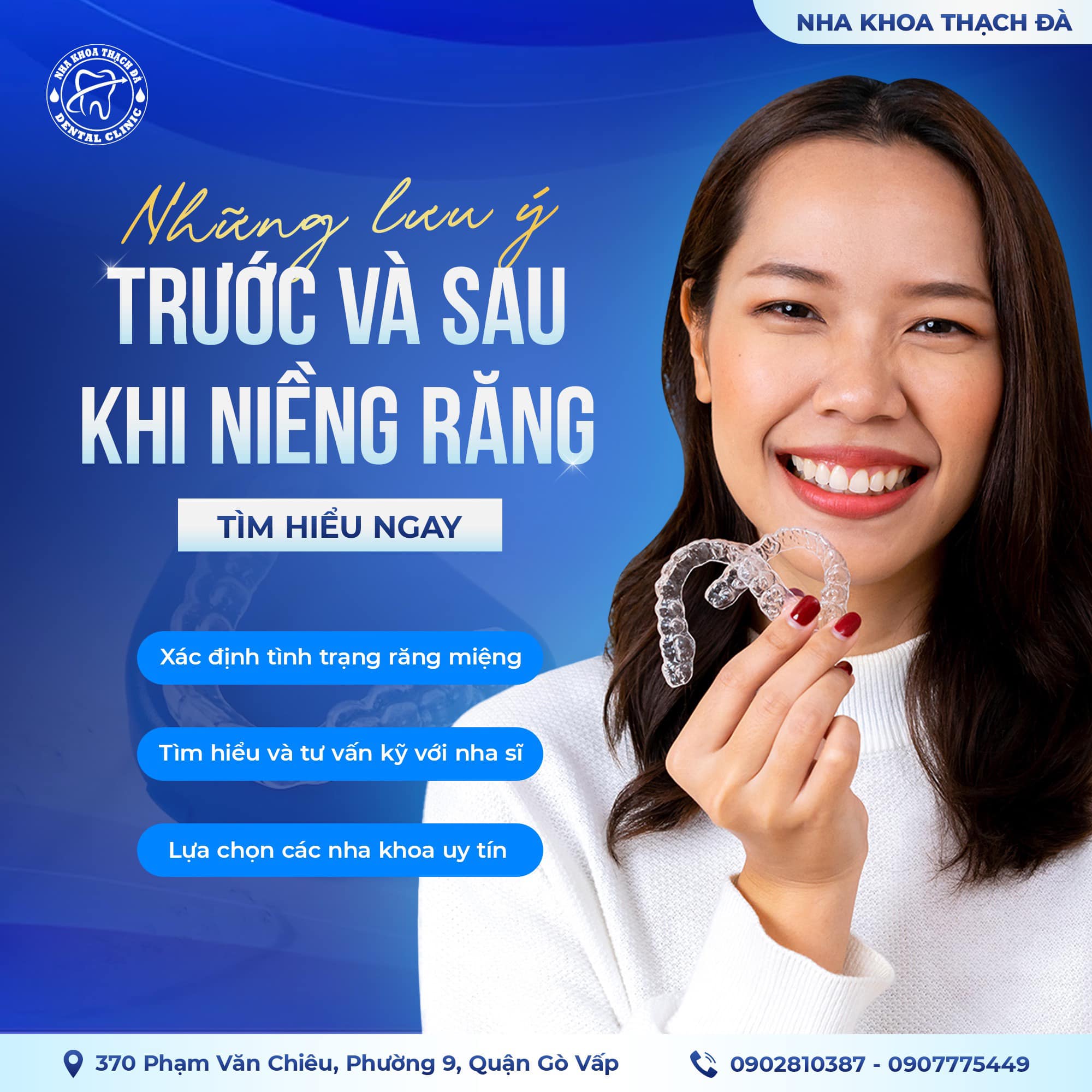 Những lưu ý trước và sau khi niềng răng