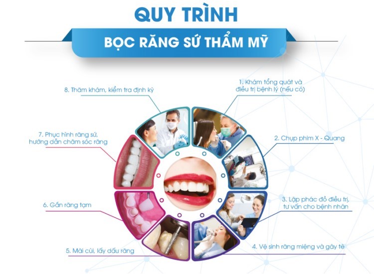 BỌC RĂNG SỨ